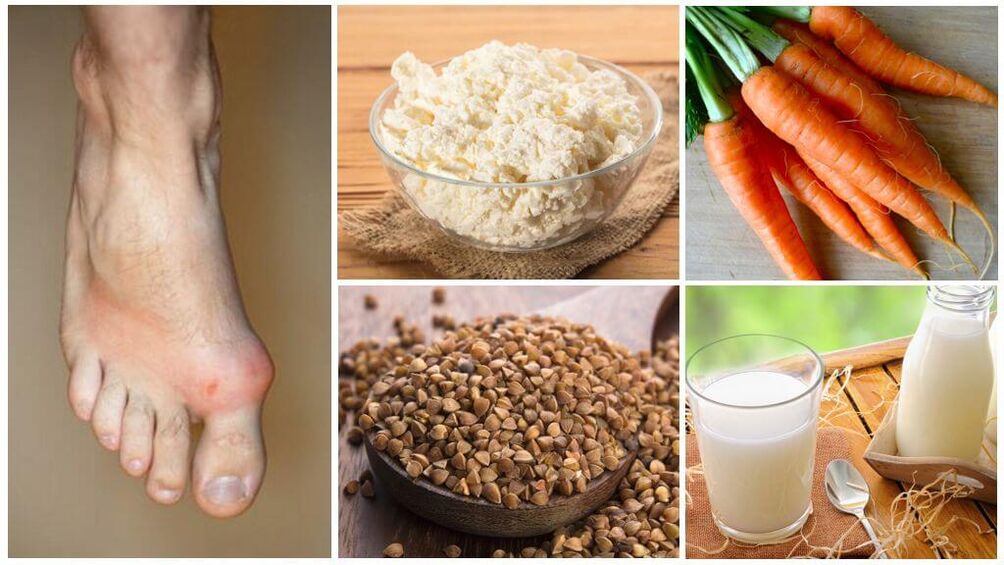 foods for gout
